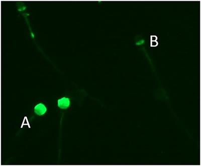 Case Report: Orchiopexy in Two Poodle Dogs and Its Effect on Their Sperm Quality Parameters